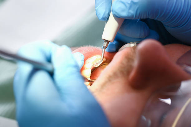 Best Pediatric Emergency Dentist in Slidell, LA